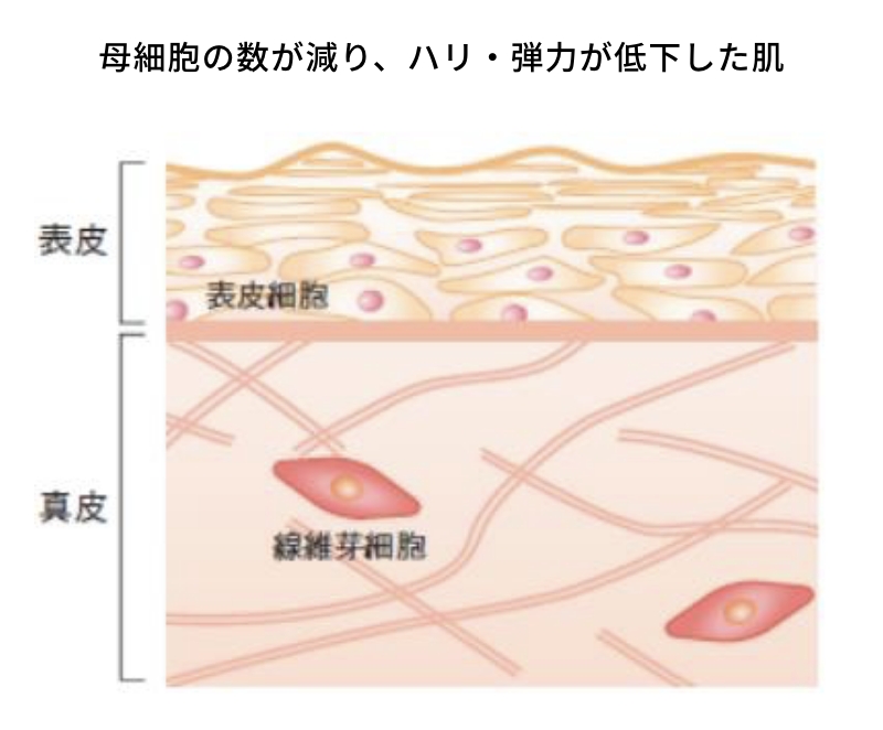 図：母細胞の数が減り、ハリ・弾力が低下した肌