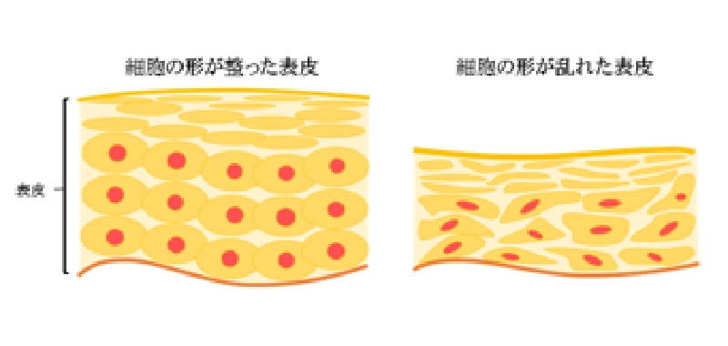 図（左）：細部の形が整った表皮 図（右）：細部の形が乱れた表皮