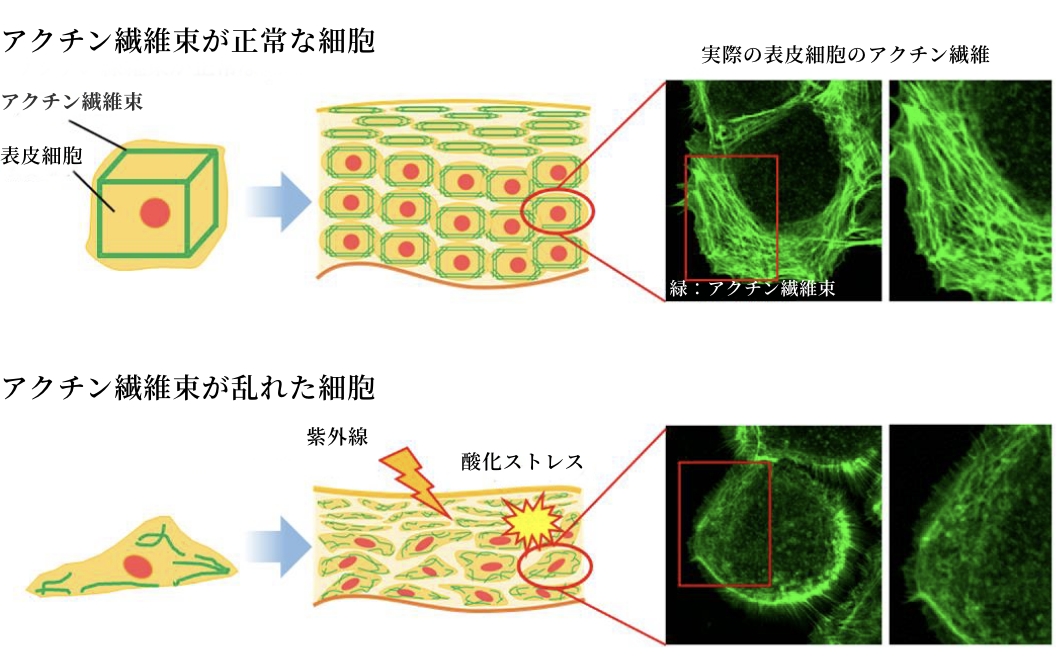 図（上）：アクチン繊維束が正常な細胞 図（下）：アクチン繊維束が乱れた細胞
