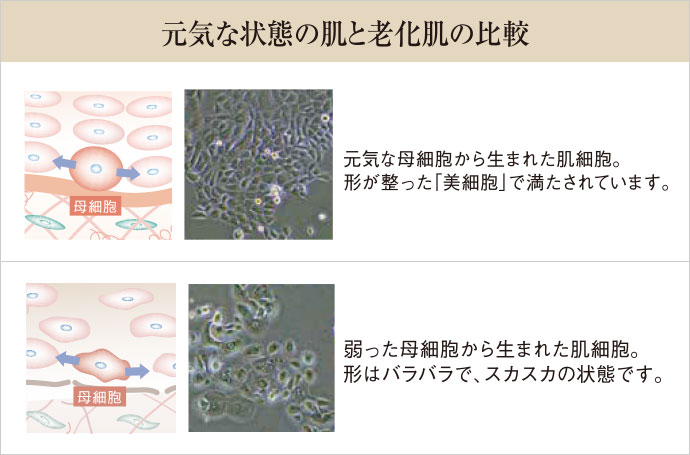 元気な状態の肌と老化肌の比較