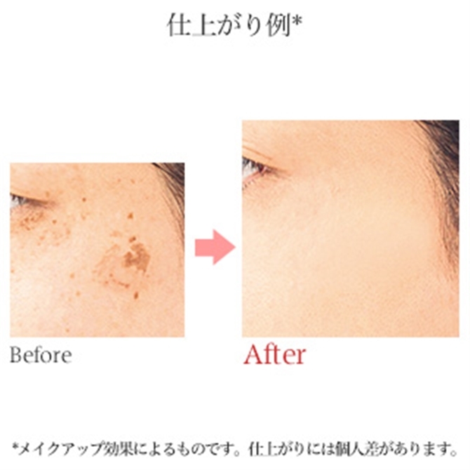 フローレス フィット（リフィル） FN10