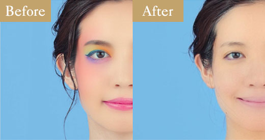 Before After