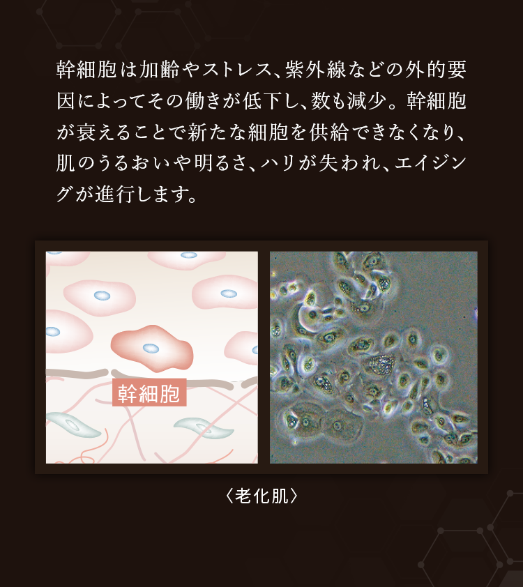 幹細胞は加齢やストレス、紫外線などの外的要因によってその働きが低下し、数も減少。 幹細胞が衰えることで新たな細胞を供給できなくなり、肌のうるおいや明るさ、ハリが失われ、エイジングが進行します。