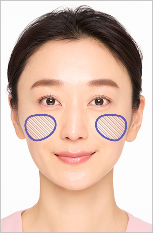 フローレス フィットお試し