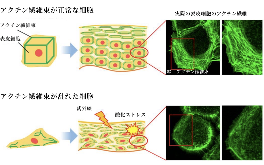 図(上):アクチン繊維束が正常な細胞 図(下):アクチン繊維束が乱れた細胞