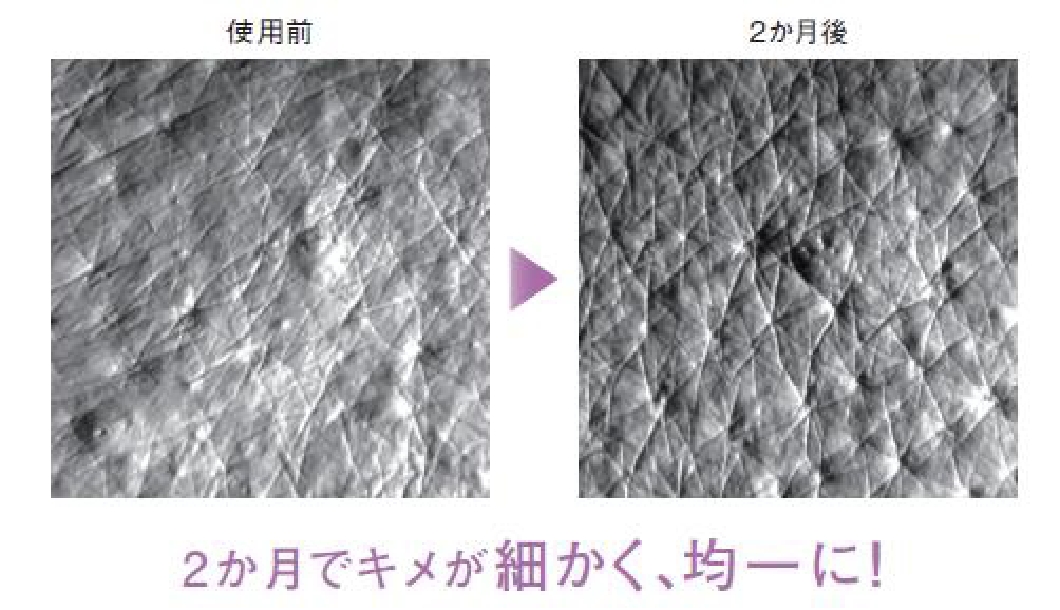 2か月でキメが細かく、均一に!